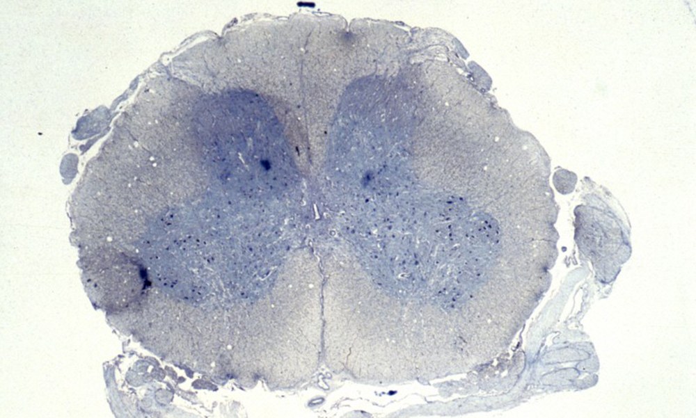 N0010265 Normal spinal cord, transverse section - Wellcome Photo Library, Wellcome Images