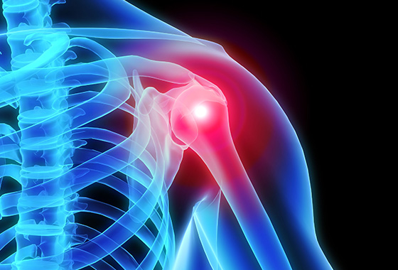 Is non-operative management of anterior shoulder instability effective ...